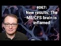 067 New Results The ME CFS Brain Is Inflamed