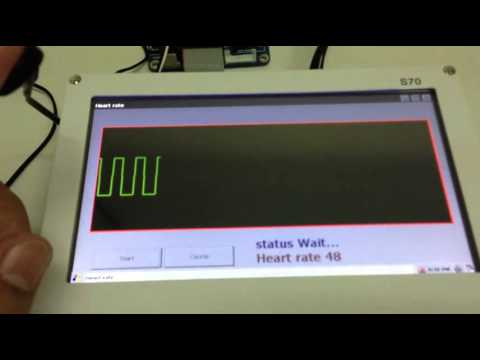 download lagu mp3 mp4 Ear Clip Heart Rate Monitor, download lagu Ear Clip Heart Rate Monitor gratis, unduh video klip Ear Clip Heart Rate Monitor