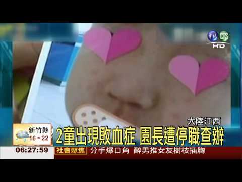 幼兒園裝潢害中毒 2童敗血症