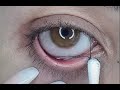 EYE string removal HACKS COMPILATION - Beauty Tips For Every Girl 2022