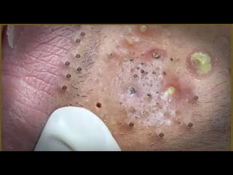 World Sac Dep SPA, 54– Ultimate Relaxation & Massage Therapy