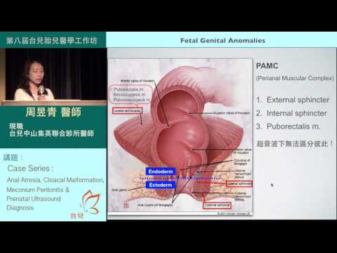 第八屆工作坊：Case Series/Fetal Genital Anomalies