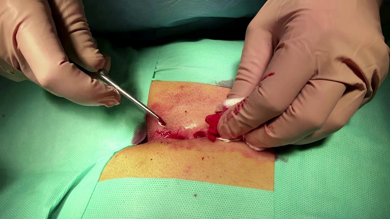 Antonio Bergantino-15