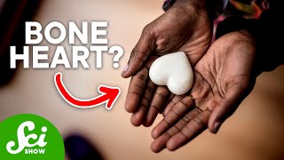 Why Do Heart Cells Turn into Bone?