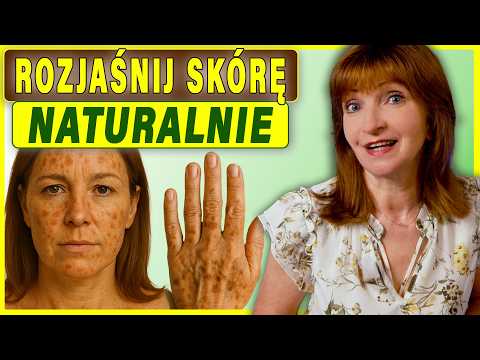Co smarować na Przebarwienia Skóry? 5 naturalnych substancji. Część 2