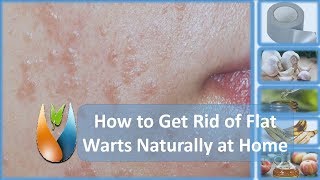 How to Cure Flat Warts Naturally at Home