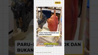 Download lagu Paru paru perokok vs bukan perokok mp3 Download lagu Paru paru perokok vs bukan perokok mp3