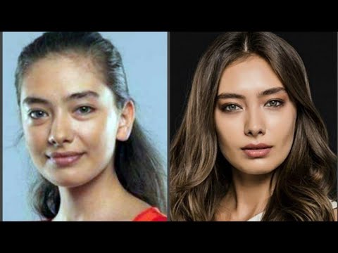 PLASTIK OPERATSIYA QILDIRGAN TURK AKTRISALARI!!! Турецкие актрисы до и после пластики