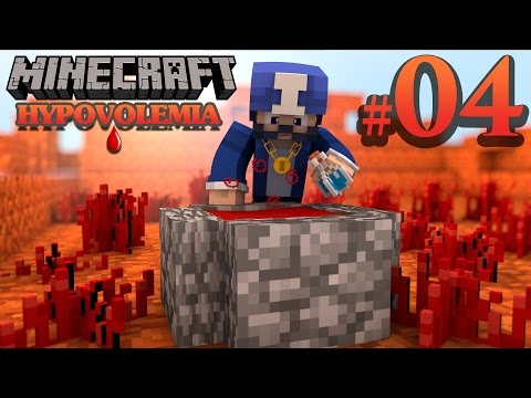 HYPOVOLEMIA  FR ep 4 : MINECRAFT MODPACK [FR] Francais