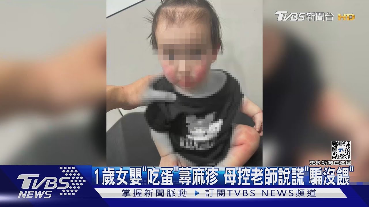 1歲女嬰「吃蛋」蕁麻疹 母控老師說謊「騙沒餵」
