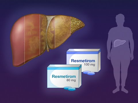 Resmetirom for NASH with Liver Fibrosis | NEJM