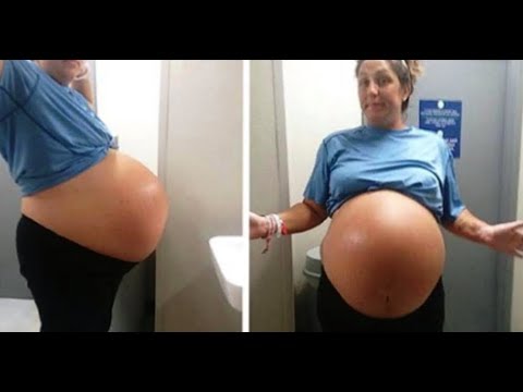 Une mère au ventre géant😲 donne naissance au plus gros bébé🤰que les médecins aient jamais vu.😳 Video