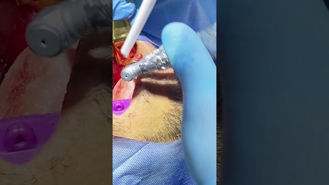 Hugo Enrique Aguilar Lamas-167