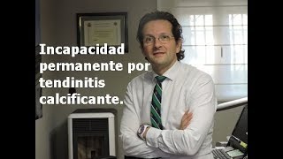 Incapacidad permanente por tendinitis calcificante.