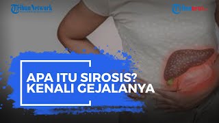 Apa Itu Sirosis? Kenali Gejalanya