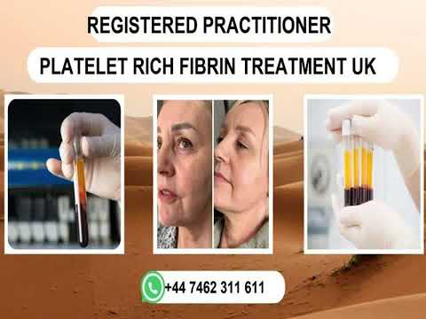 The Best, +44 7462 311 611 Beauty Clinics PRF Treatment UK Chester