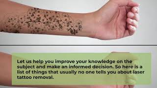 Things No One Tells You About Tattoo Removal