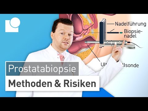 Prostatabiospie: Methoden & Risiken – Gewebeentnahme zur sicheren Prostatakrebs-Diagnose