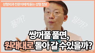 쌍꺼풀 풀기, 원래대로 돌아올까?