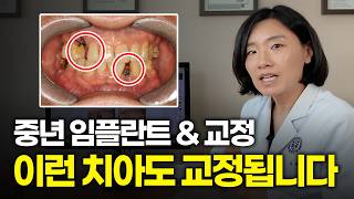유튜브썸네일