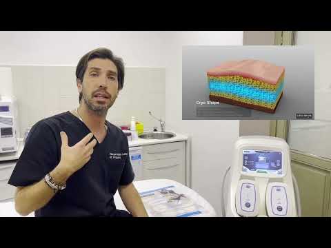 Criolipolisi video