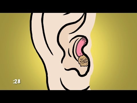 What Is Ear Wax For? | WebMD