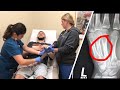 I BROKE MY HAND Caught On Camera