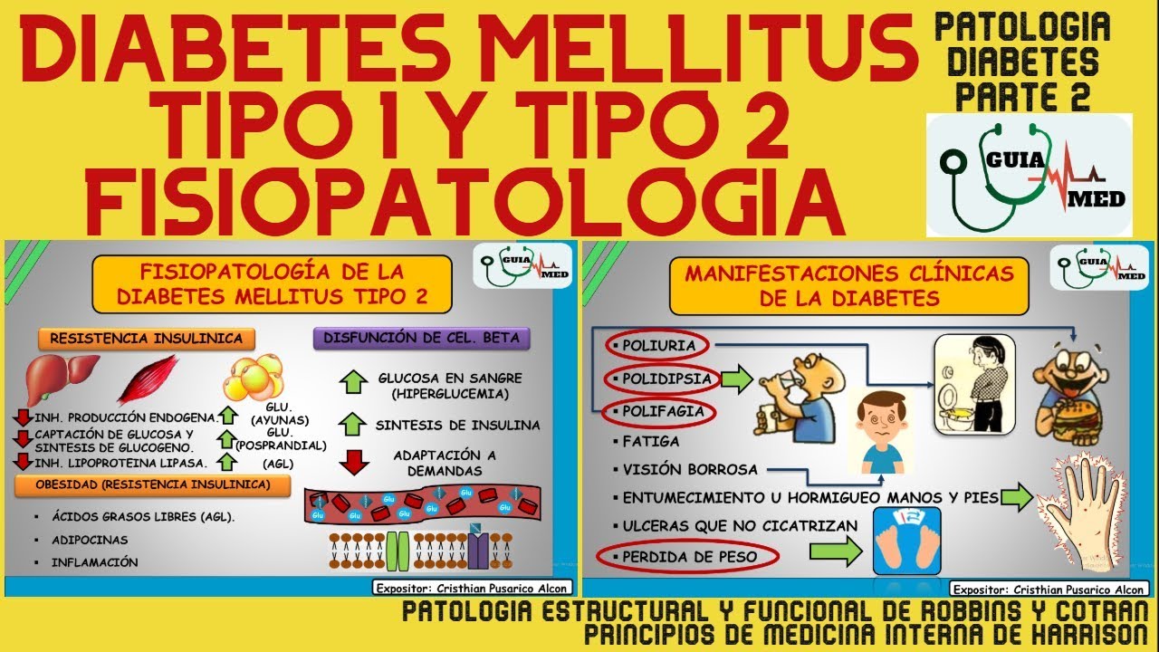 FISIOPATOLOGÍA DE LA DIABETES MELLITUS TIPO 1 Y TIPO 2 | GuiaMed