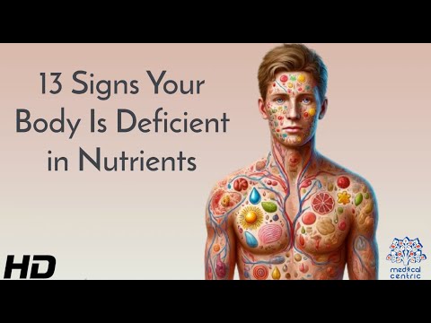 Nutrient Deficiency: 13 Symptoms You Shouldn't Ignore