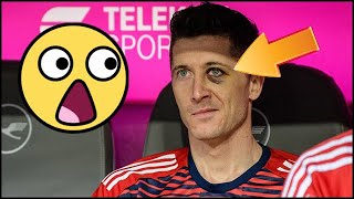 5 CHOSES QUE VOUS IGNOREZ SUR LEWANDOWSKI