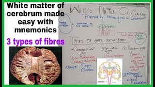 White Matter Of Cerebrum| and Fibers (Commissural, Association & Projection)