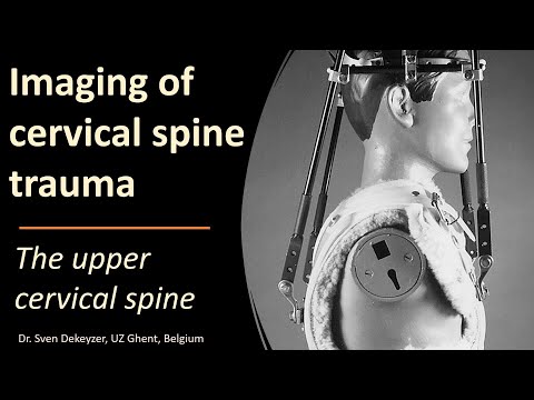 Imaging of Upper Cervical Spine Injuries
