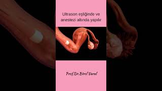 Tüp Bebekte Yumurta Toplama İşlemi
