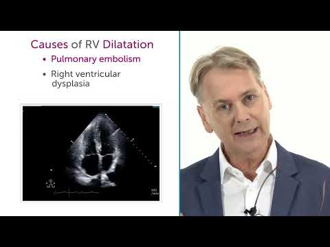 Why can the RV be dilated?