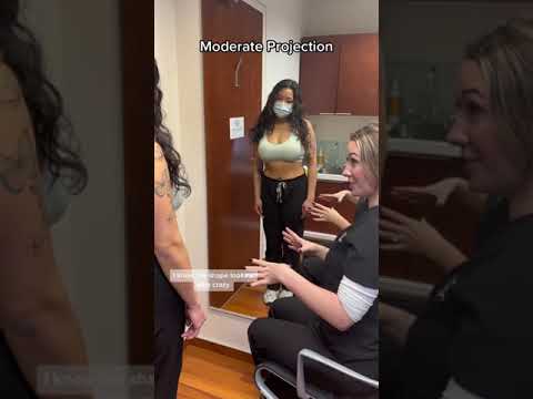 Breast Augmentation Sizing Consultation