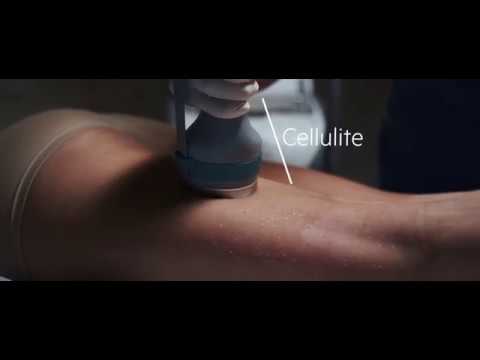 CoolWaves, le traitement raffermissant chez Maison Lutétia Paris