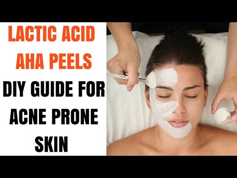 Chemical Peels for Acne Prone Skin