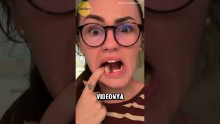 Download lagu What's wrong with this woman's teeth😱 #shorts #uniquefacts mp3 Download lagu What's wrong with this woman's teeth😱 #shorts #uniquefacts mp3