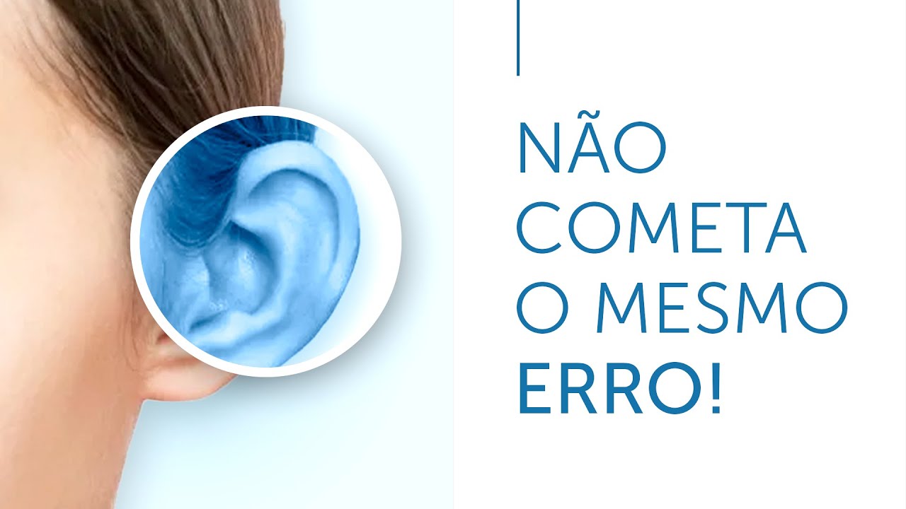 Otoplastia fechada - Paciente se arrepende e procura Dr Mauro Speranzini para consertar