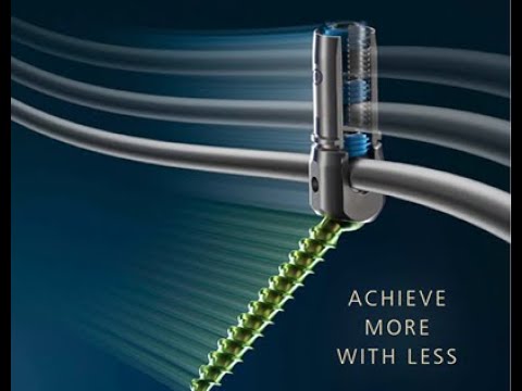 DepuySynthes: Expedium Verse Fracture