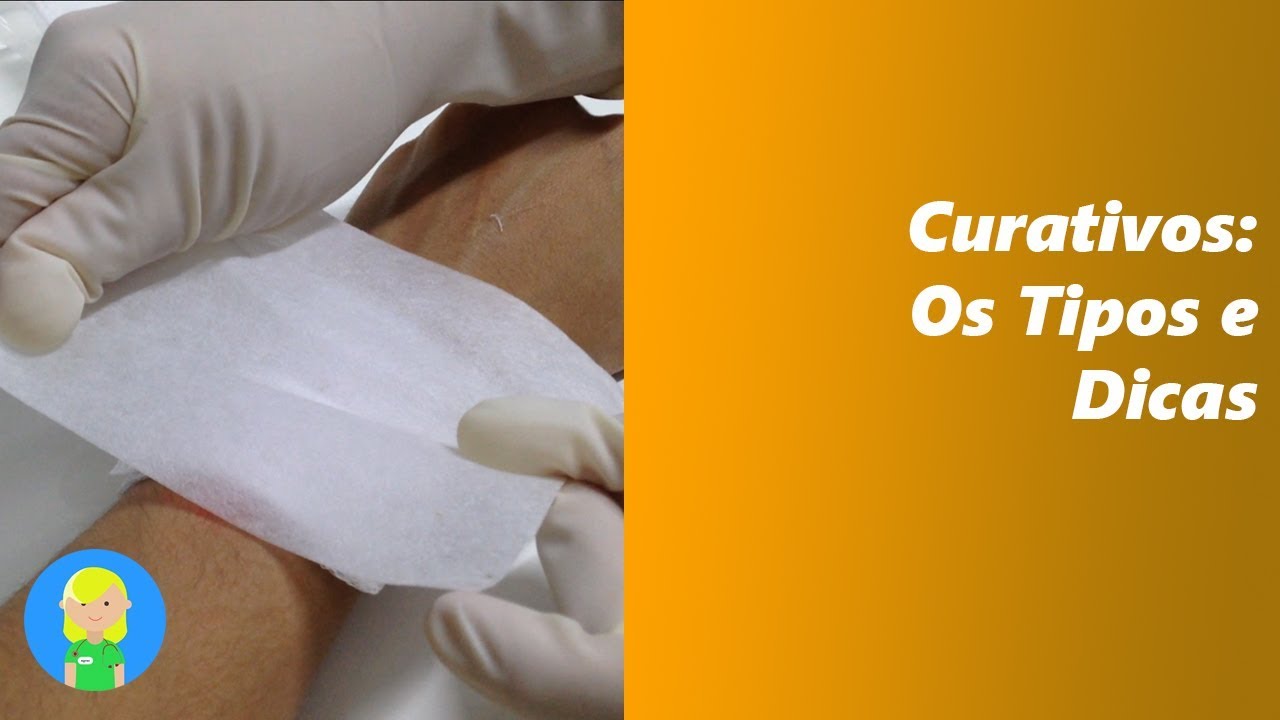 Curativos: Tipos e Dicas