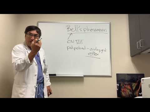 Bell’s phenomenon in NOP