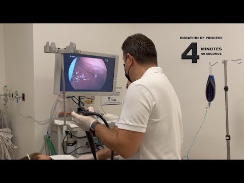 Gastric Balloon Placement / Dr. Onur Peşluk