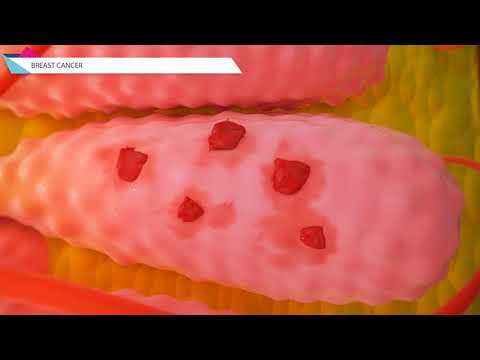 Medical animation - Viral Marketing Hub