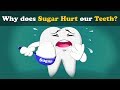 Why Does Sugar Hurt Our Teeth Aumsum Kids Science Education Children