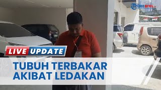 Kesaksian Korban Selamat Ledakan Bom JW Marriott 2003, Tak Curiga hingga Alami Luka Bakar 42 Persen