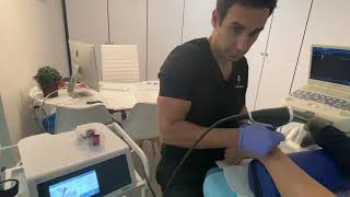 Calcificación tendón de aquiles