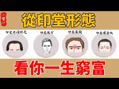 印堂是哪裏
