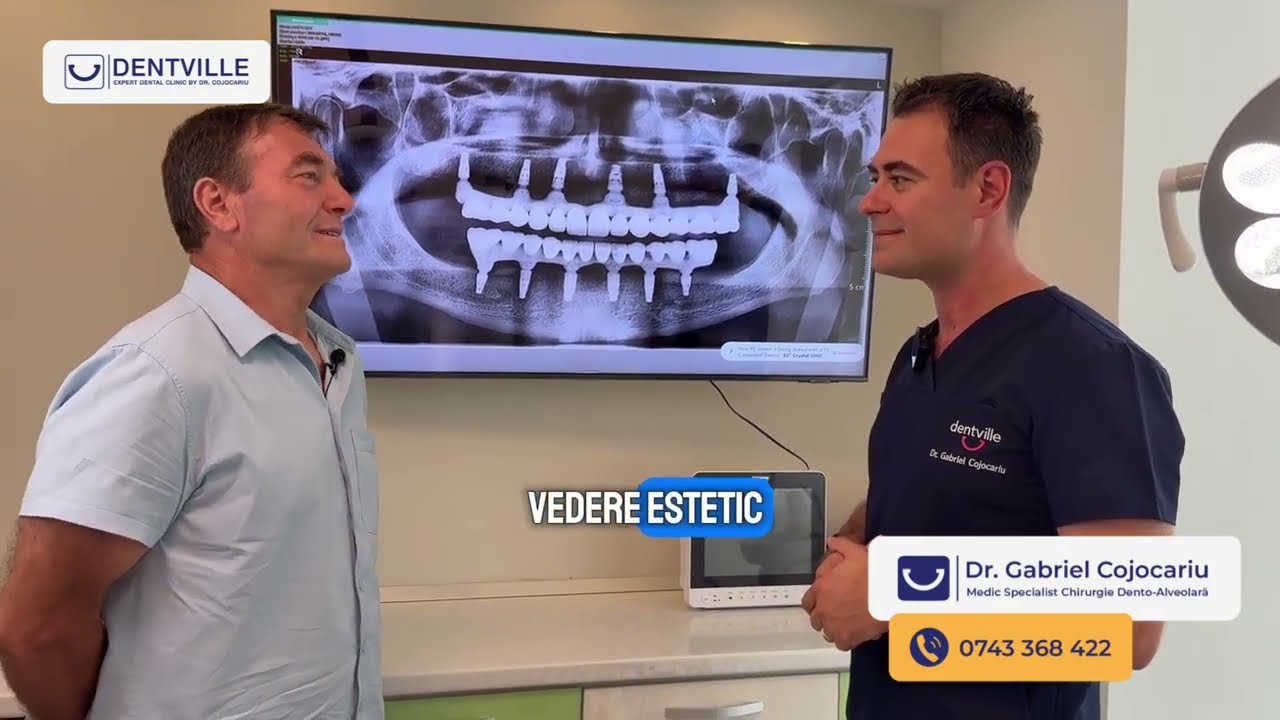 <div style="text-align: left; white-space: normal; overflow: hidden; display: -webkit-box; -webkit-line-clamp: 2; -webkit-box-orient: vertical; line-height: 1.3em;">De la planificare la zâmbet larg: 12 implanturi în aceeași ședință I Caz real</div>