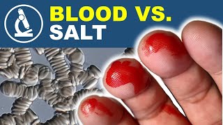 Watch SALT destroy BLOOD CELLS under the microscope